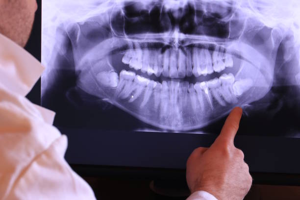 Best Emergency Denture Repair in Estelle, LA